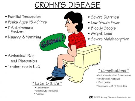crohn's disease causes