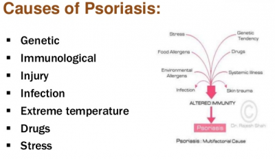 causes of psoriasis