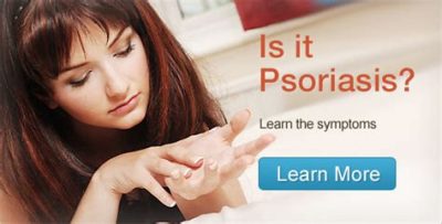 what is psoriasis