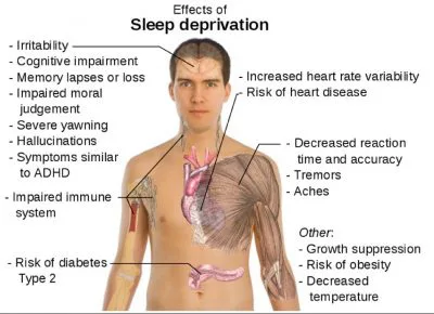 risks of sleep deprivation