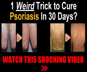 cure for psoriasis