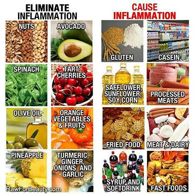 Foods to Avoid for Inflammation