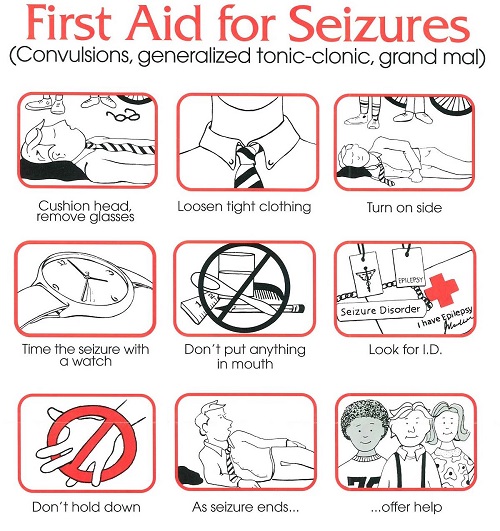 what to do for seizures