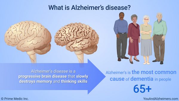 what's alzheimers