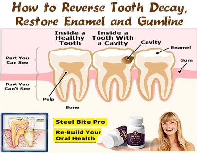 heal cavities naturally